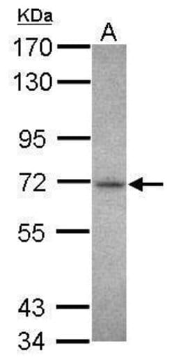 Invitrogen CHK2 Polyclonal Antibody 100 &mu;L; Unconjugated:Antibodies,