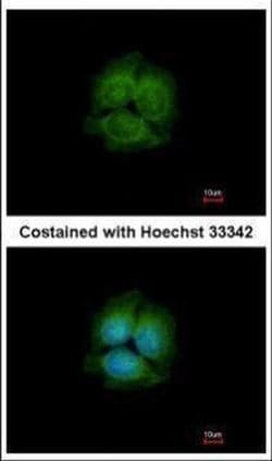 Invitrogen LRRK2 Polyclonal Antibody 100 &mu;L; Unconjugated:Antibodies,