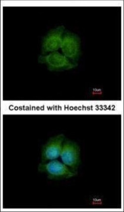 Invitrogen LRRK2 Polyclonal Antibody 100 &mu;L; Unconjugated:Antibodies,