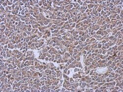 Invitrogen LRRK2 Polyclonal Antibody 100 &mu;L; Unconjugated:Antibodies,