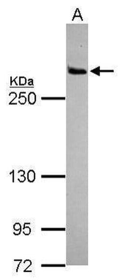 Invitrogen LRRK2 Polyclonal Antibody 100 &mu;L; Unconjugated:Antibodies,