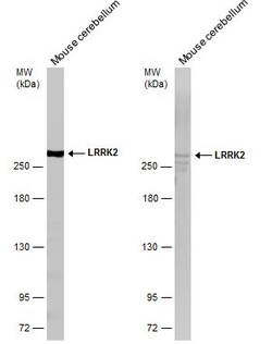 Invitrogen LRRK2 Polyclonal Antibody 100 &mu;L; Unconjugated:Antibodies,