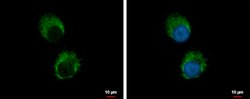 Invitrogen IL-1 alpha Polyclonal Antibody 100 &mu;L; Unconjugated:Antibodies,