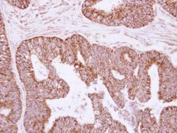 Invitrogen IL-1 alpha Polyclonal Antibody 100 &mu;L; Unconjugated:Antibodies,
