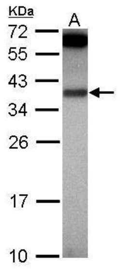 Invitrogen IL-1 alpha Polyclonal Antibody 100 &mu;L; Unconjugated:Antibodies,
