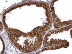 TUBA4A Polyclonal Antibody, Invitrogen 100 &mu;L | Buy Online | Invitrogen | Fisher Scientific