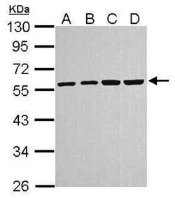 TUBA4A Polyclonal Antibody, Invitrogen 100 &mu;L | Buy Online | Invitrogen | Fisher Scientific