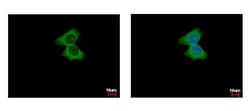 Invitrogen alpha Actinin 4 Polyclonal Antibody 100 &mu;L; Unconjugated:Antibodies,
