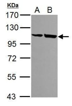 Invitrogen alpha Actinin 4 Polyclonal Antibody 100 &mu;L; Unconjugated:Antibodies,