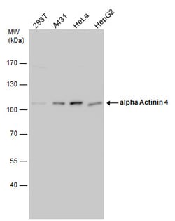Invitrogen alpha Actinin 4 Polyclonal Antibody 100 &mu;L; Unconjugated:Antibodies,