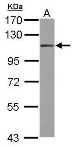 Invitrogen alpha Actinin 4 Polyclonal Antibody 100 &mu;L; Unconjugated:Antibodies,