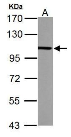Invitrogen alpha Actinin 4 Polyclonal Antibody 100 &mu;L; Unconjugated:Antibodies,