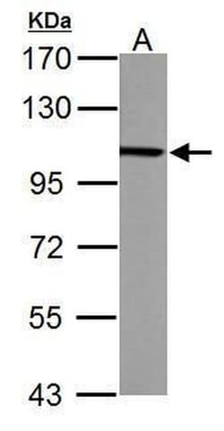 Invitrogen alpha Actinin 4 Polyclonal Antibody 100 &mu;L; Unconjugated:Antibodies,