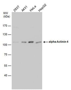 Invitrogen alpha Actinin 4 Polyclonal Antibody 100 &mu;L; Unconjugated:Antibodies,