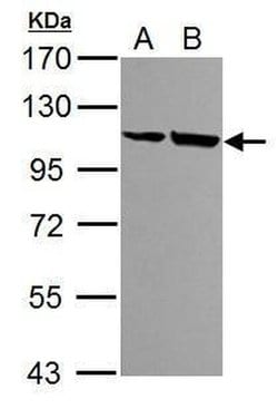 Invitrogen alpha Actinin 4 Polyclonal Antibody 100 &mu;L; Unconjugated:Antibodies,