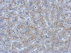 Invitrogen CEA Polyclonal Antibody 100 &mu;L; Unconjugated:Antibodies,