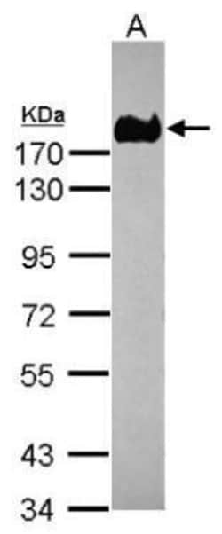 Invitrogen CEA Polyclonal Antibody 100 &mu;L; Unconjugated:Antibodies,
