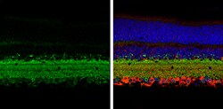 Invitrogen GAD67 Polyclonal Antibody 100 &mu;L; Unconjugated:Antibodies,