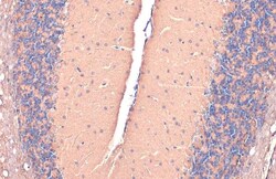Invitrogen GAD67 Polyclonal Antibody 100 &mu;L; Unconjugated:Antibodies,