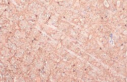 Invitrogen GAD67 Polyclonal Antibody 100 &mu;L; Unconjugated:Antibodies,