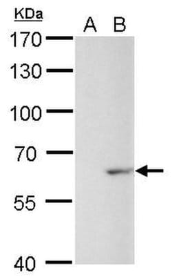 Invitrogen GAD67 Polyclonal Antibody 100 &mu;L; Unconjugated:Antibodies,
