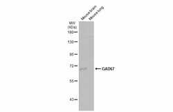 Invitrogen GAD67 Polyclonal Antibody 100 &mu;L; Unconjugated:Antibodies,