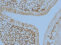 Invitrogen PAX6 Polyclonal Antibody 100 &mu;L | Buy Online | Invitrogen&trade; | Fisher Scientific