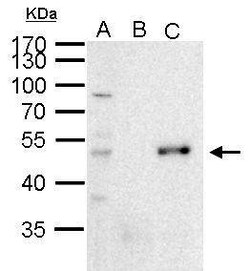 Invitrogen PAX6 Polyclonal Antibody 100 &mu;L | Buy Online | Invitrogen&trade; | Fisher Scientific