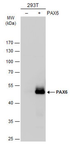Invitrogen PAX6 Polyclonal Antibody 100 &mu;L | Buy Online | Invitrogen&trade; | Fisher Scientific