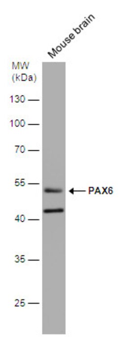 Invitrogen PAX6 Polyclonal Antibody 100 &mu;L | Buy Online | Invitrogen&trade; | Fisher Scientific