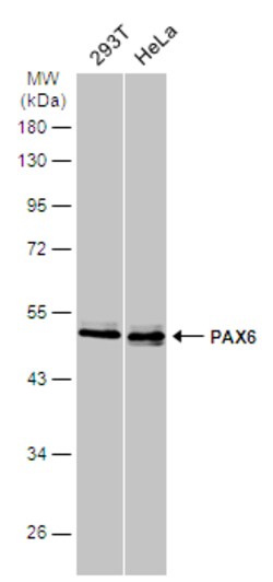 Invitrogen PAX6 Polyclonal Antibody 100 &mu;L | Buy Online | Invitrogen&trade; | Fisher Scientific