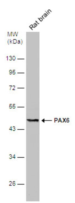 Invitrogen PAX6 Polyclonal Antibody 100 &mu;L | Buy Online | Invitrogen&trade; | Fisher Scientific