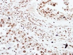 Invitrogen HDAC3 Polyclonal Antibody 100 &mu;L; Unconjugated:Antibodies,