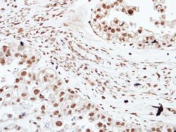 Invitrogen HDAC3 Polyclonal Antibody 100 &mu;L; Unconjugated:Antibodies,