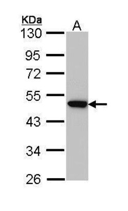 Invitrogen AP2M1 Polyclonal Antibody 100 &mu;L; Unconjugated:Antibodies,