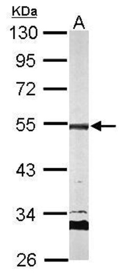 Invitrogen AP2M1 Polyclonal Antibody 100 &mu;L; Unconjugated:Antibodies,