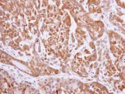 Invitrogen NQO1 Polyclonal Antibody 100 &mu;L; Unconjugated:Antibodies,