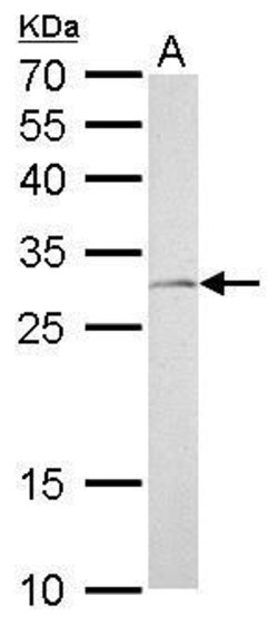 Invitrogen NQO1 Polyclonal Antibody 100 &mu;L; Unconjugated:Antibodies,