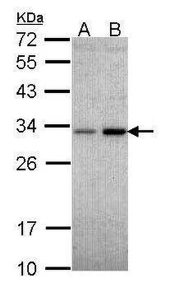 Invitrogen NQO1 Polyclonal Antibody 100 &mu;L; Unconjugated:Antibodies,
