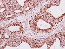 Invitrogen ERAB Polyclonal Antibody 100 &mu;L; Unconjugated:Antibodies,