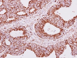 Invitrogen ERAB Polyclonal Antibody 100 &mu;L; Unconjugated:Antibodies,
