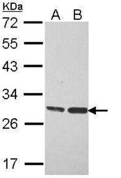 Invitrogen ERAB Polyclonal Antibody 100 &mu;L; Unconjugated:Antibodies,
