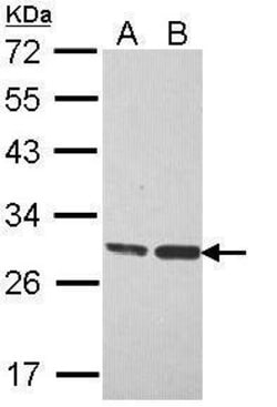 Invitrogen ERAB Polyclonal Antibody 100 &mu;L; Unconjugated:Antibodies,