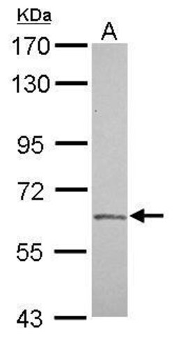 Invitrogen Factor XI Polyclonal Antibody 100 &mu;L; Unconjugated:Antibodies,