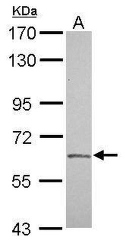 Invitrogen Factor XI Polyclonal Antibody 100 &mu;L; Unconjugated:Antibodies,