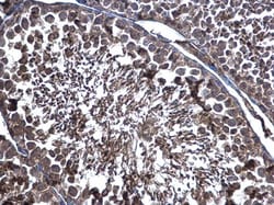 Invitrogen ERp57 Polyclonal Antibody 100 &mu;L; Unconjugated:Antibodies,