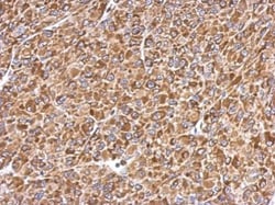Invitrogen ERp57 Polyclonal Antibody 100 &mu;L; Unconjugated:Antibodies,