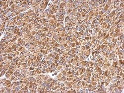Invitrogen ERp57 Polyclonal Antibody 100 &mu;L; Unconjugated:Antibodies,