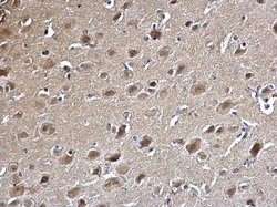 Invitrogen PSMA5 Polyclonal Antibody 100 &mu;L; Unconjugated:Antibodies,