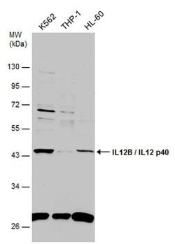 Invitrogen IL-12/IL-23 p40 Polyclonal Antibody 100 &mu;L; Unconjugated:Antibodies,